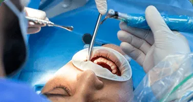 Implant surgery