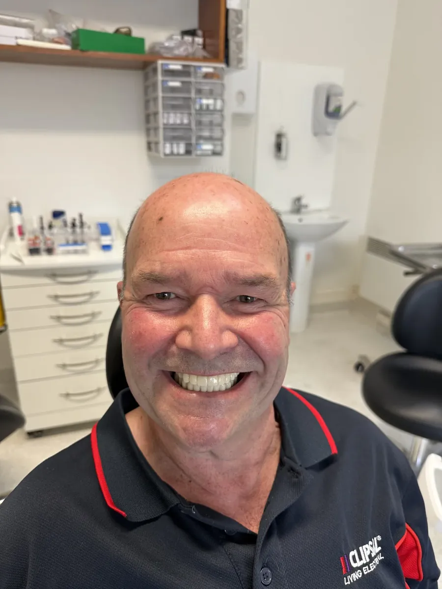 Patient after full-arch treatment